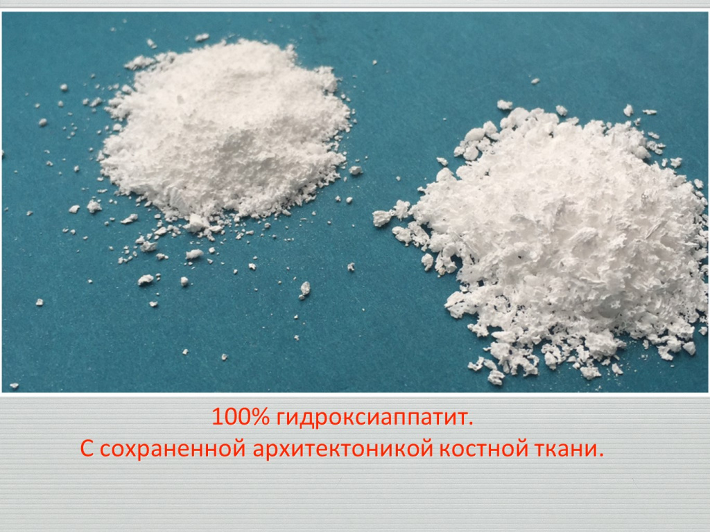 Принцип направленной костной регенерации