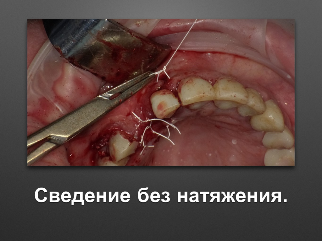 БАЛДЕЙ НОГА