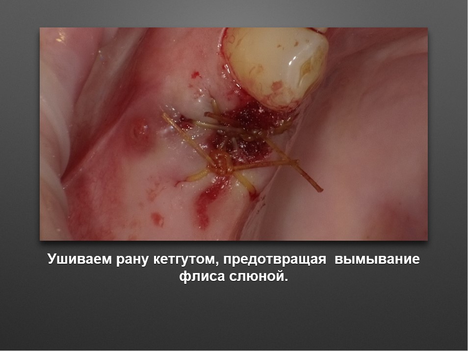Screenshot_19