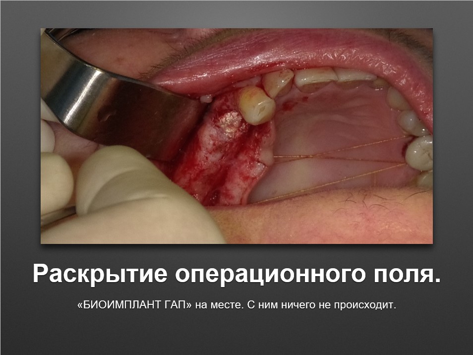 Screenshot_23