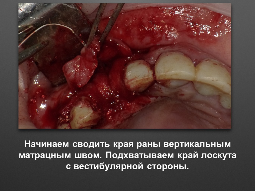 БАЛДЕЙ НОГА