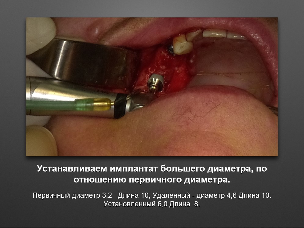 Screenshot_48