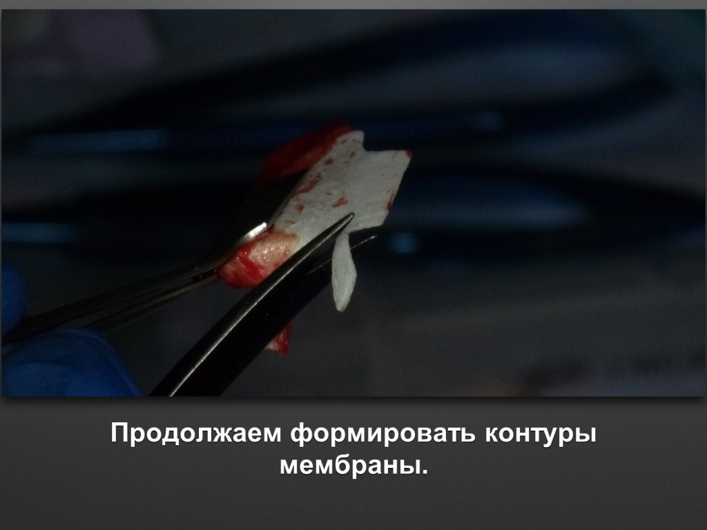БАЛДЕЙ НОГА