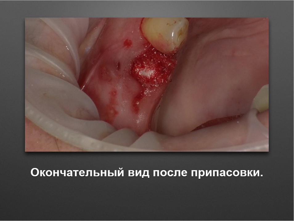 Screenshot_18