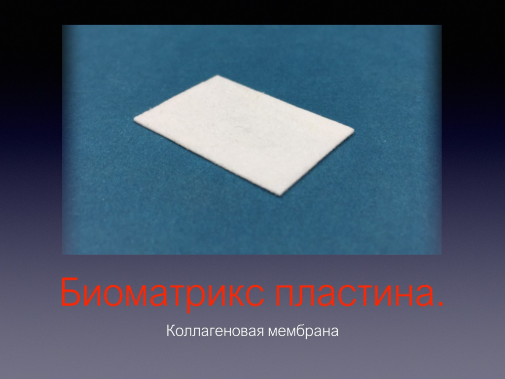 Принцип направленной костной регенерации