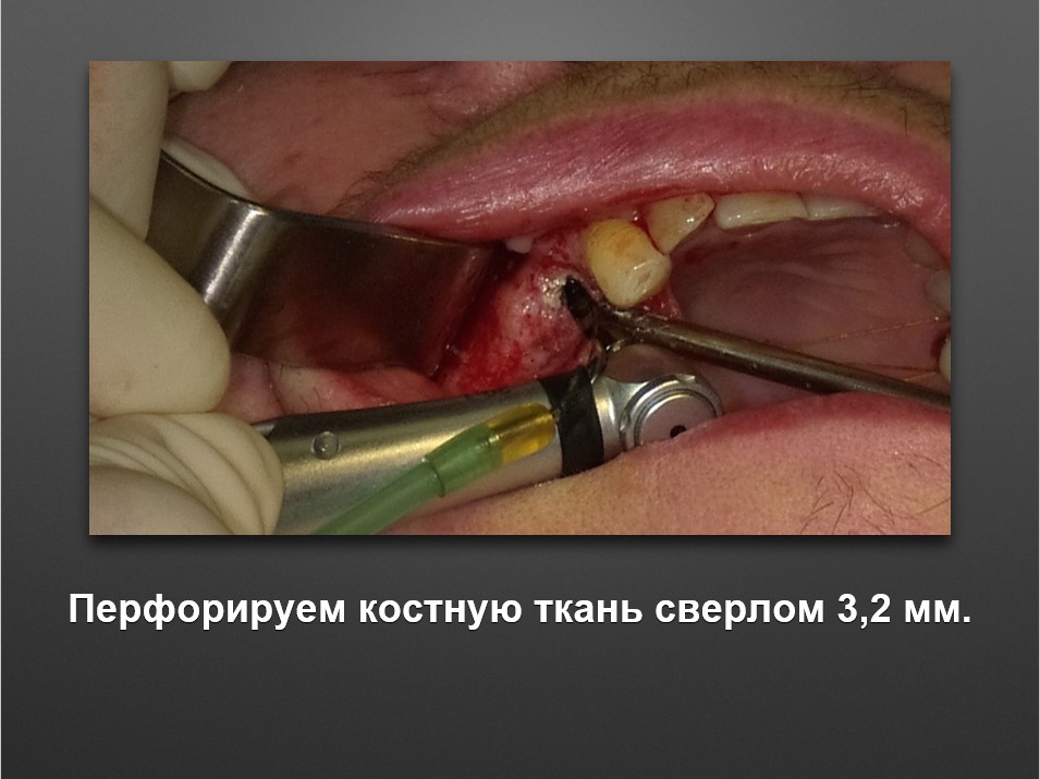 Screenshot_25