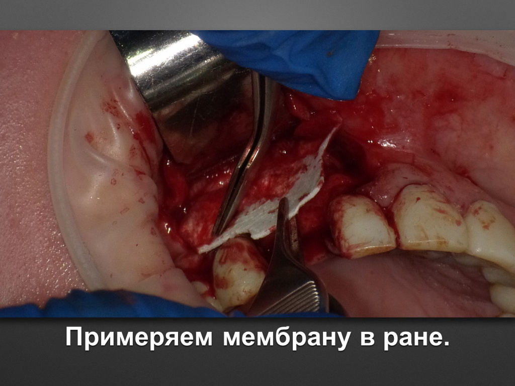 БАЛДЕЙ НОГА