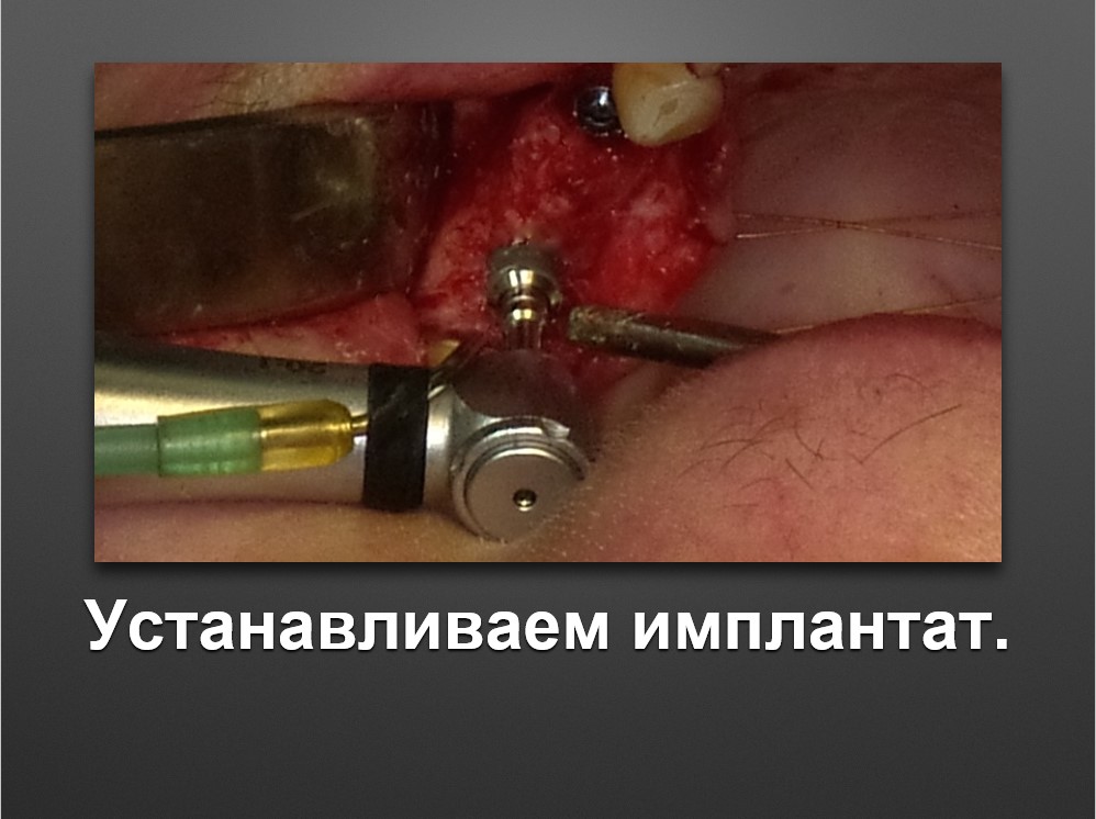 Screenshot_39