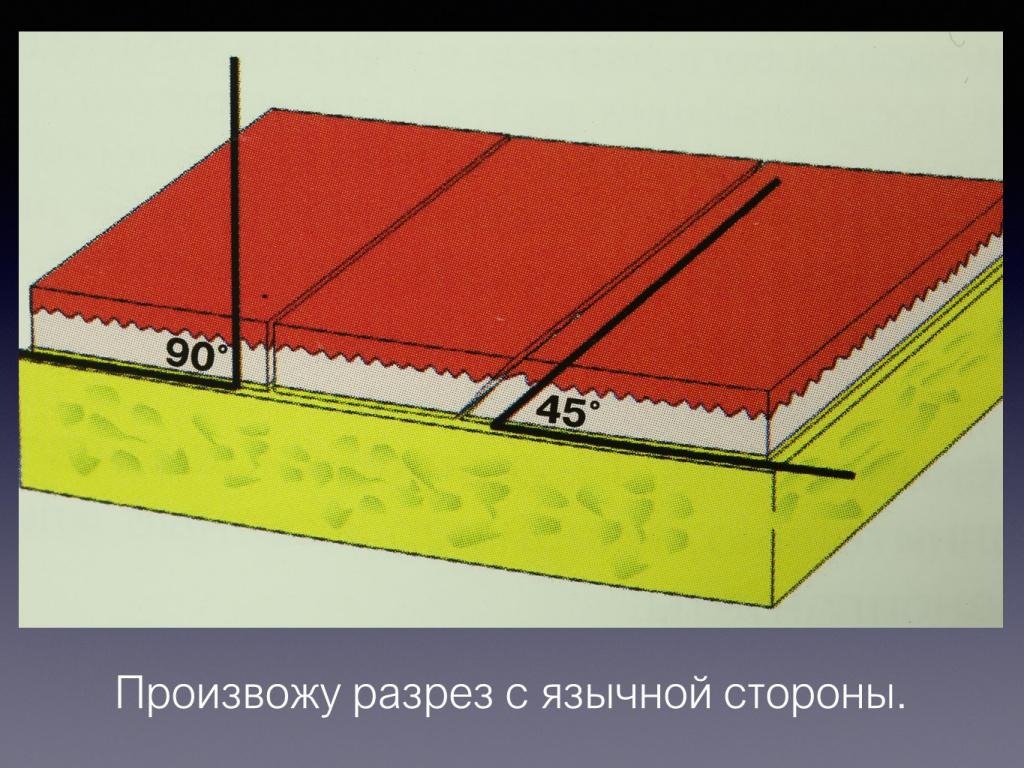 Постановка имплантата после презервации