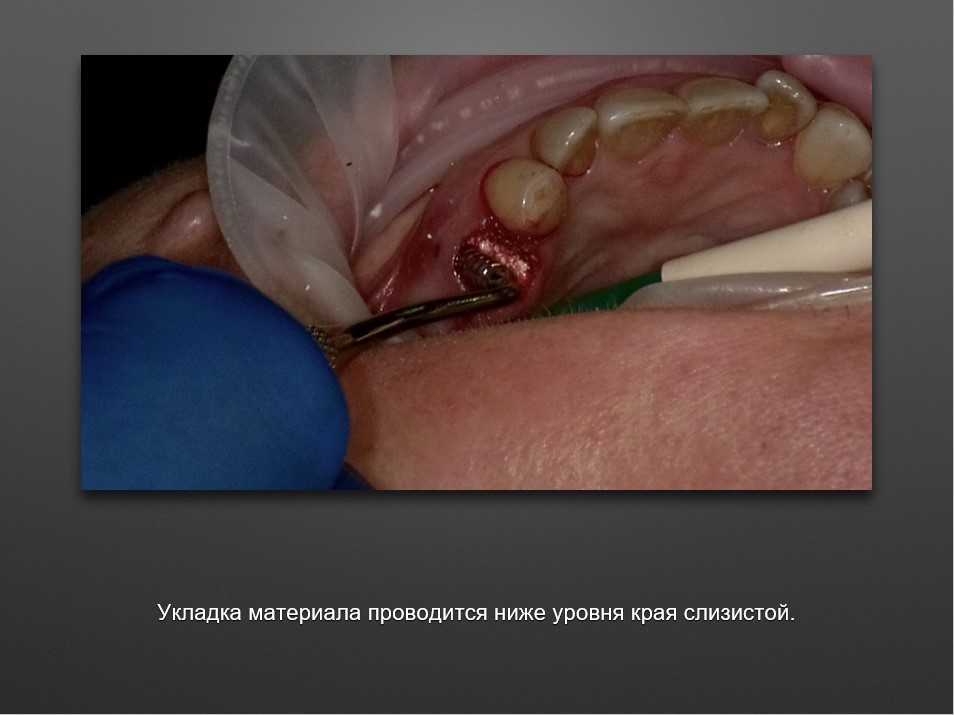 Screenshot_14
