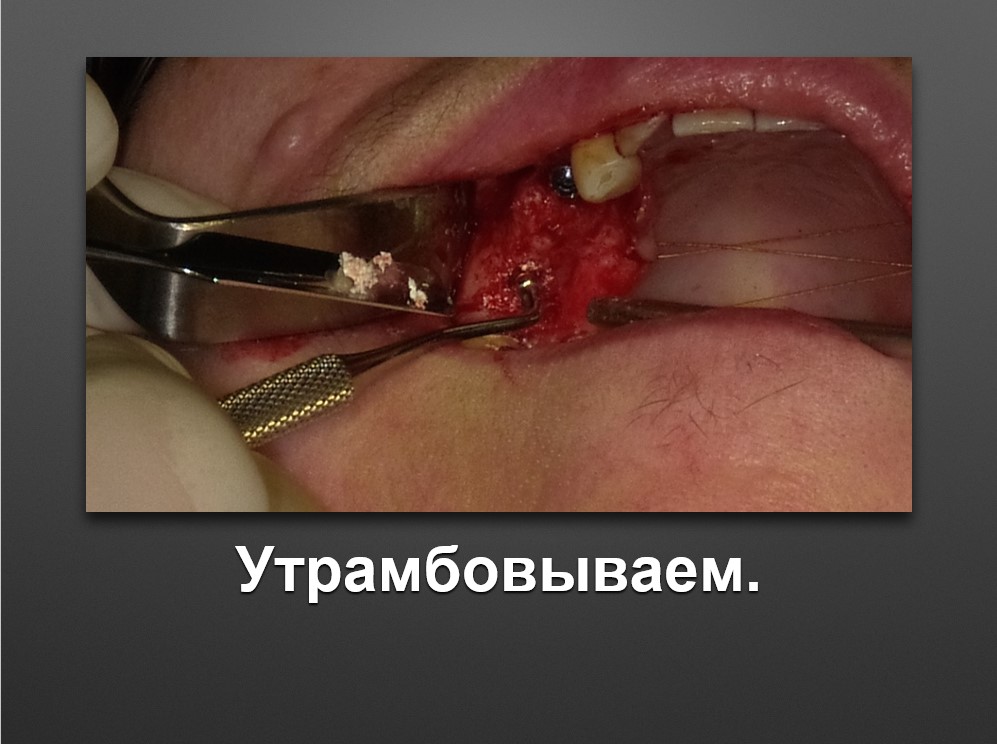 Screenshot_46