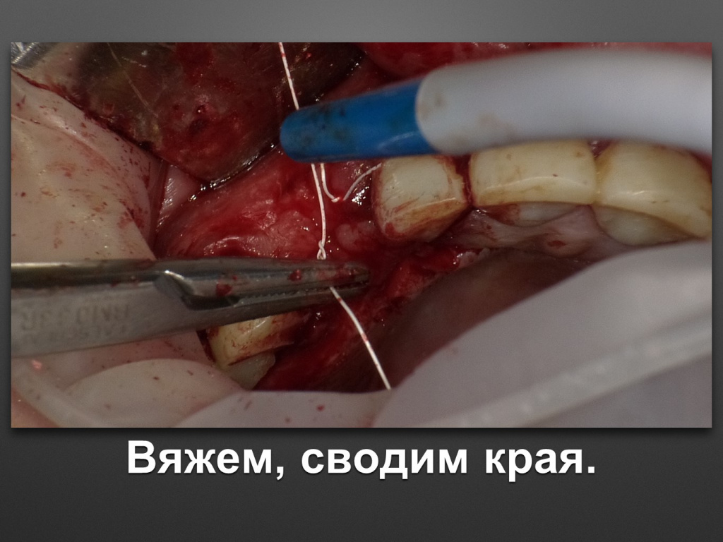 БАЛДЕЙ НОГА