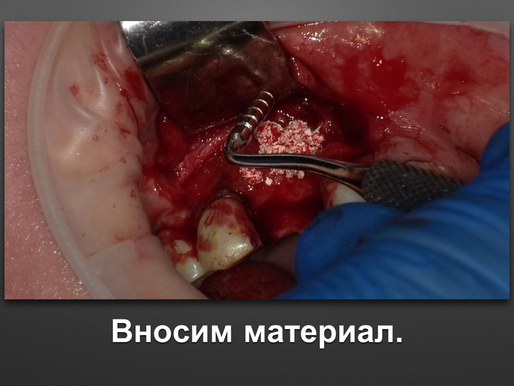БАЛДЕЙ НОГА
