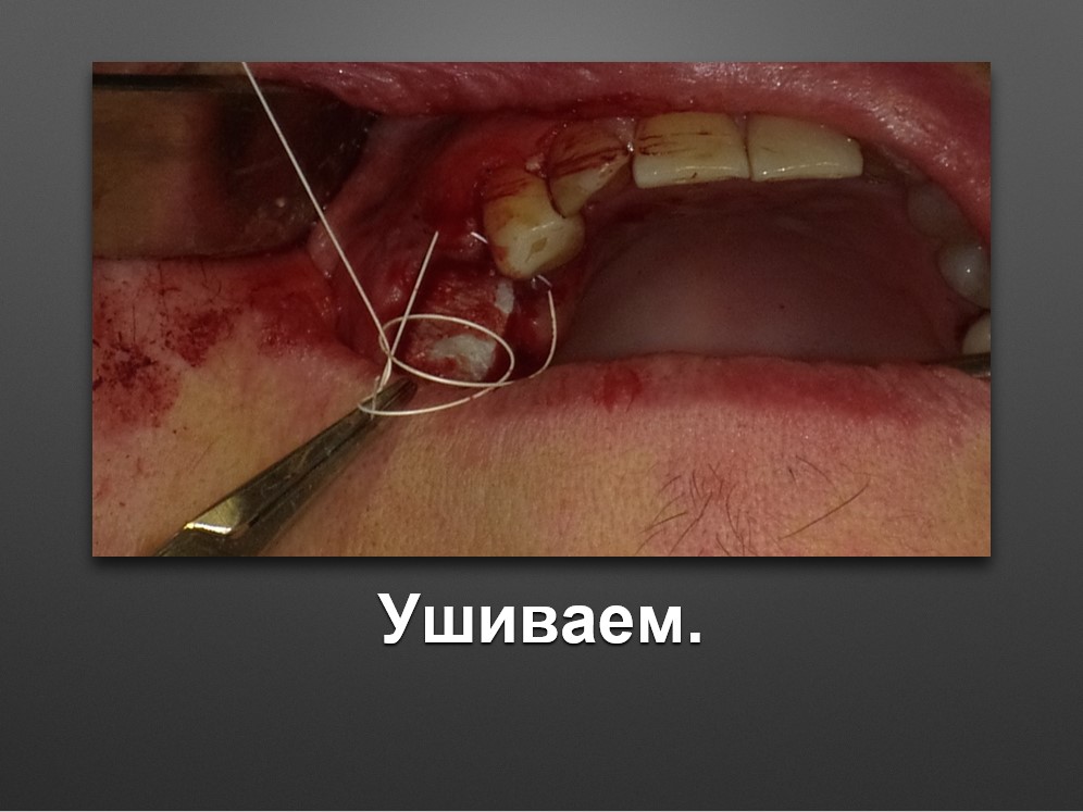 Screenshot_59