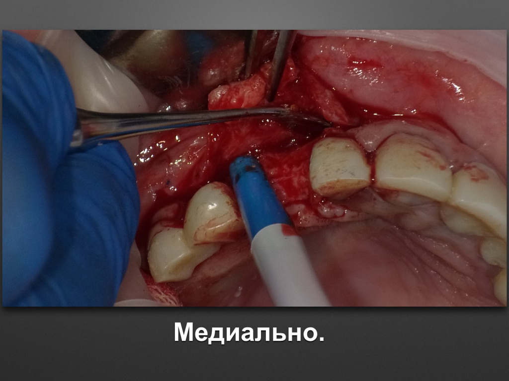 БАЛДЕЙ НОГА