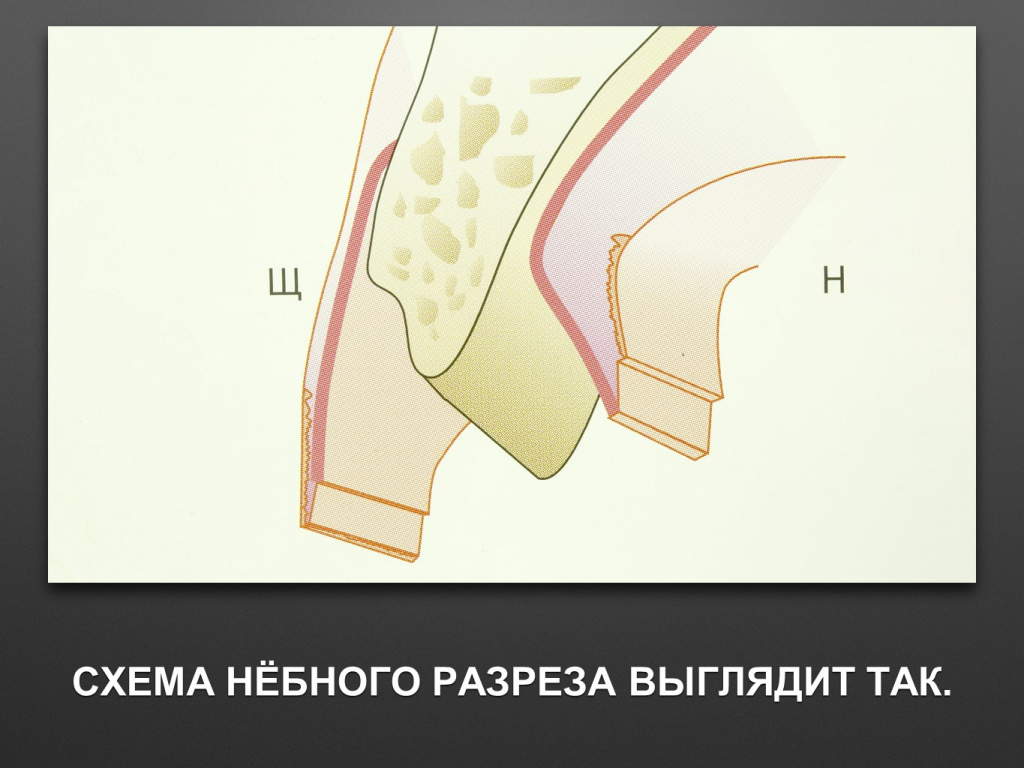 БАЛДЕЙ НОГА