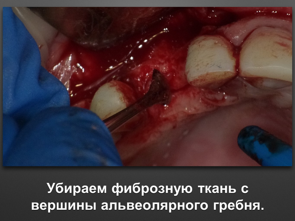 БАЛДЕЙ НОГА