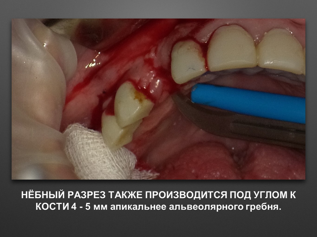 БАЛДЕЙ НОГА
