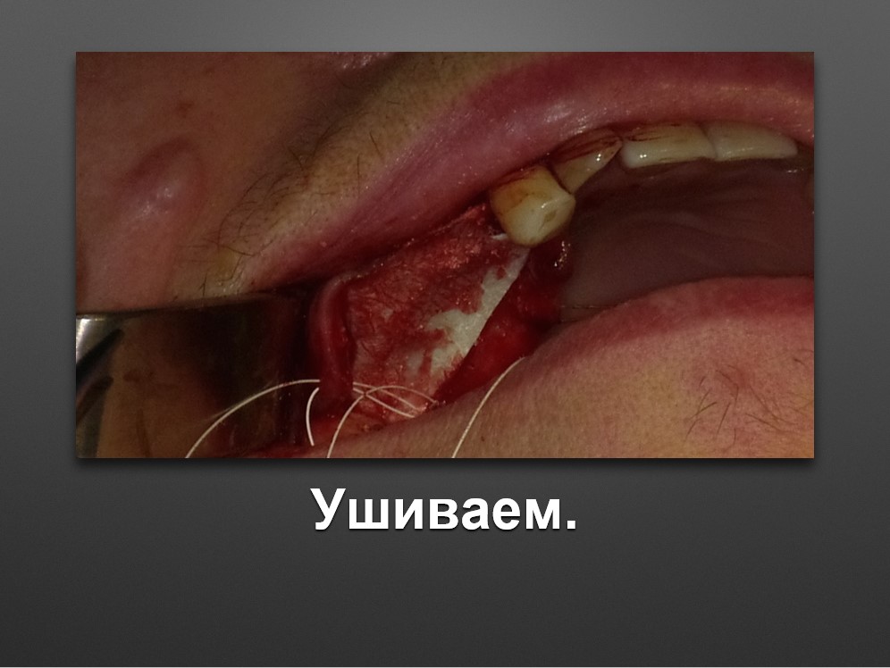 Screenshot_57