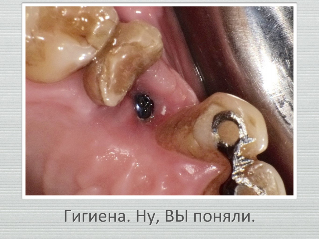 Ранозаживление