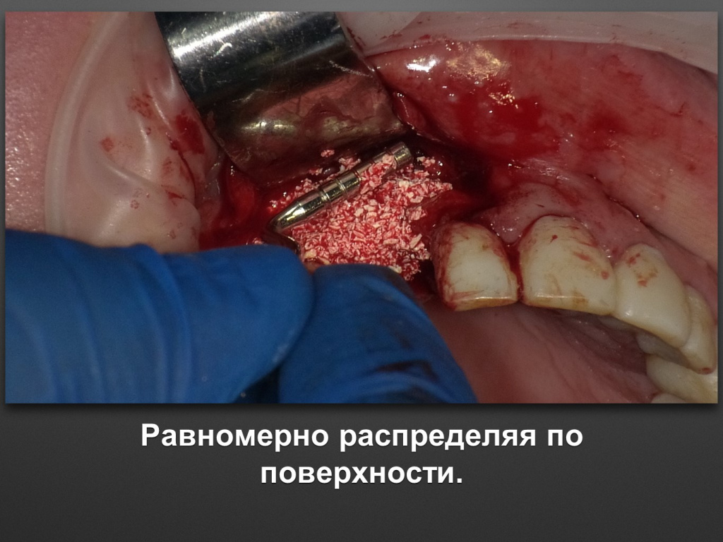 БАЛДЕЙ НОГА
