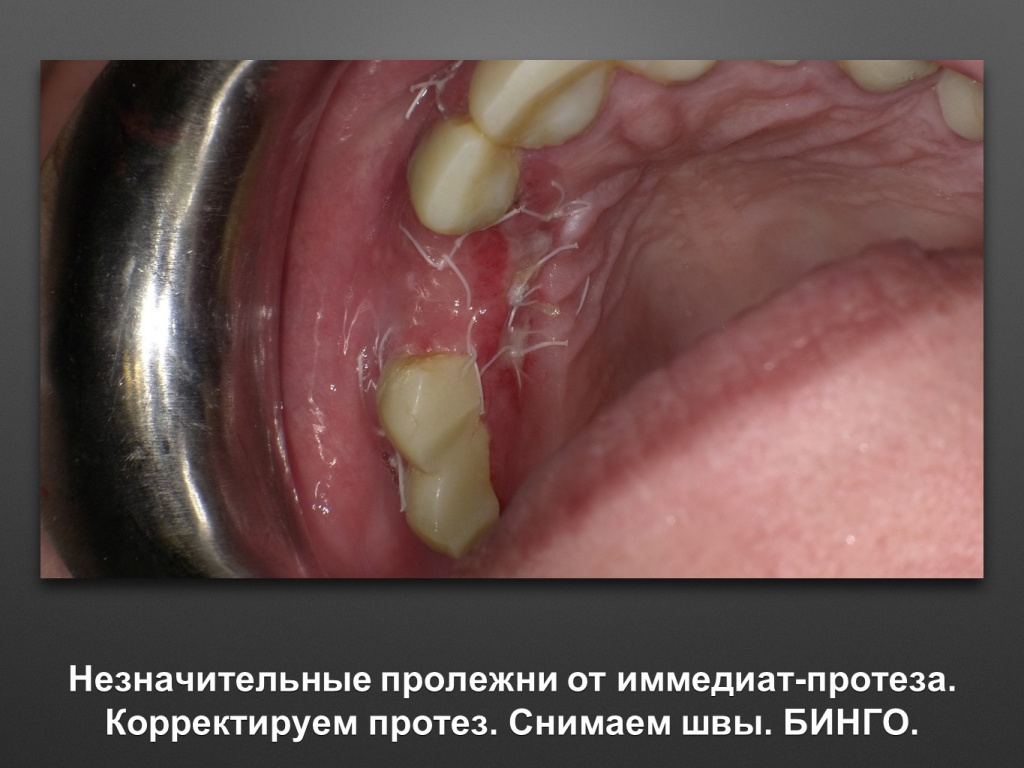 БАЛДЕЙ НОГА