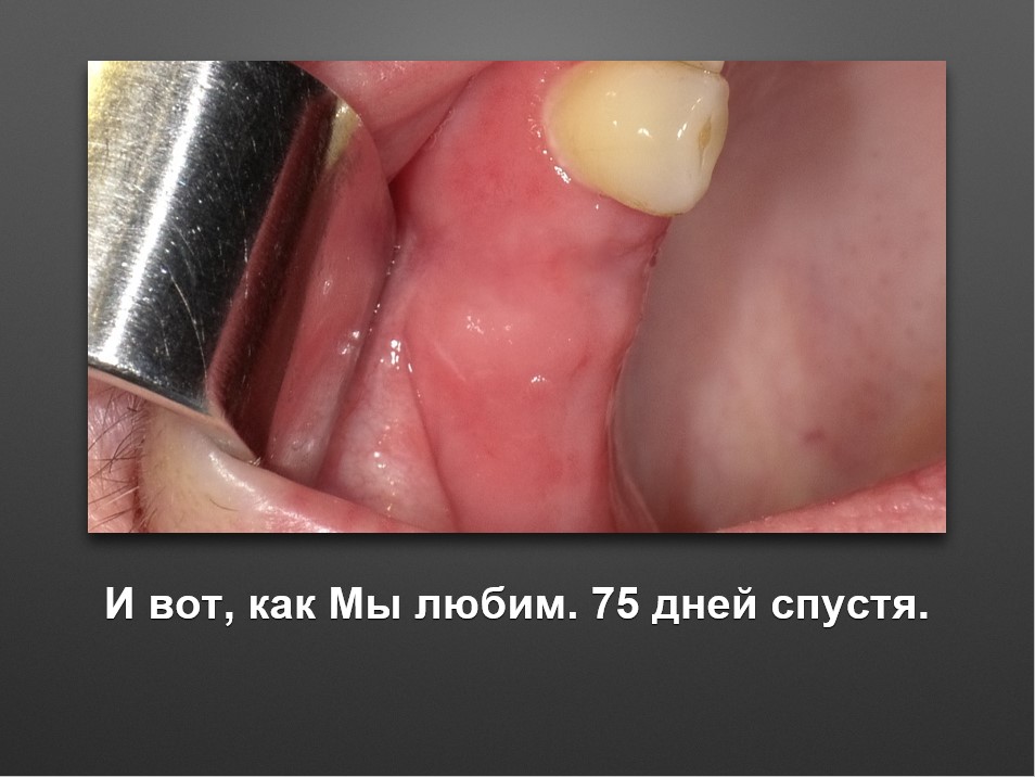Screenshot_22