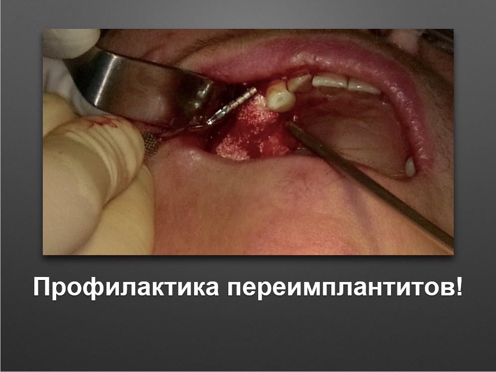 Screenshot_51