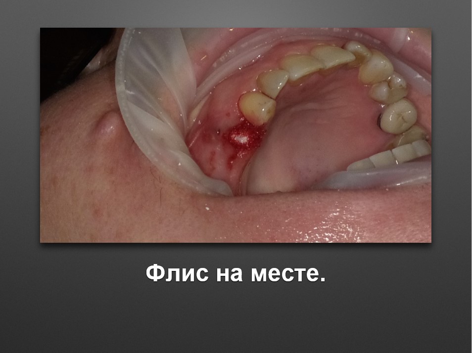 Screenshot_17