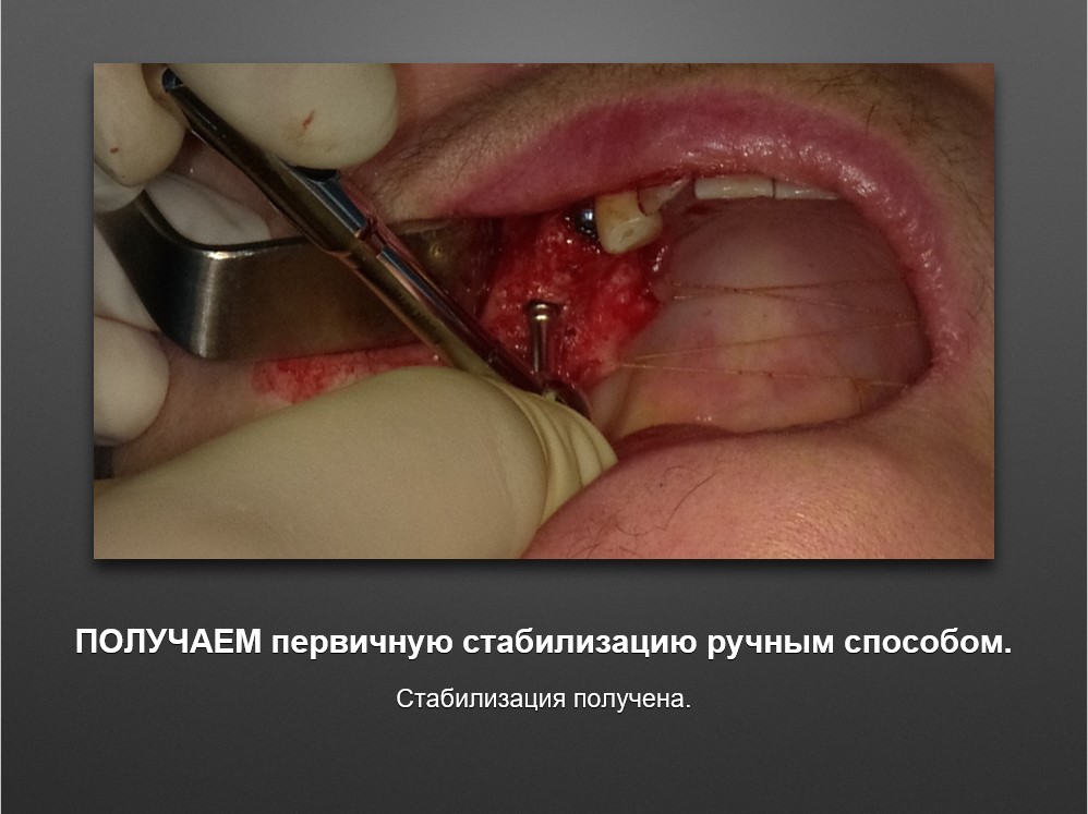 Screenshot_40