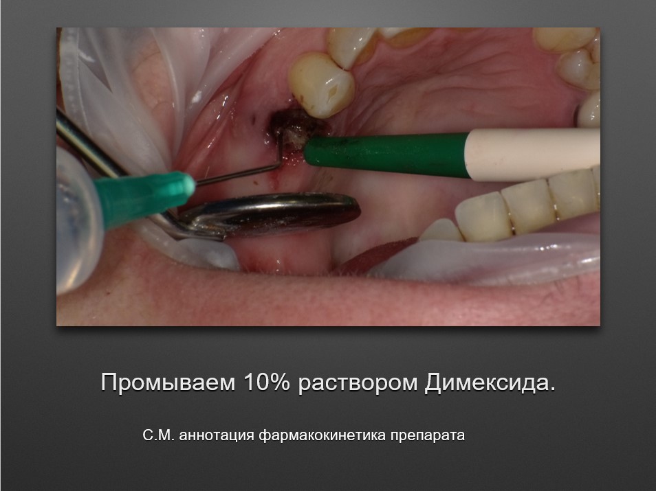 Screenshot_5