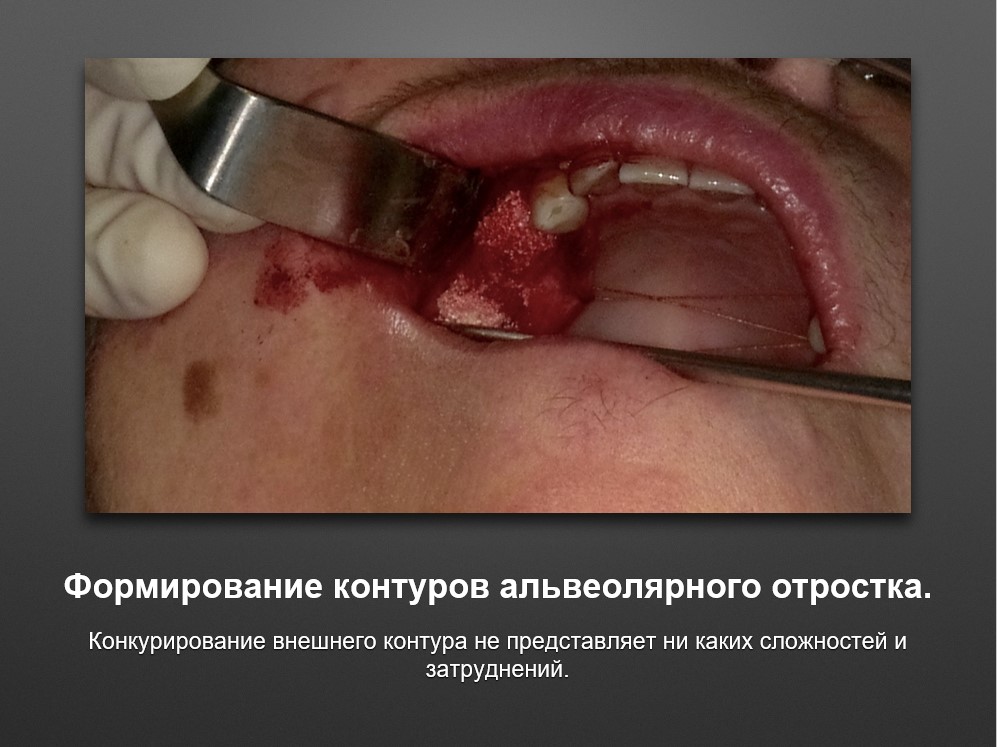 Screenshot_52