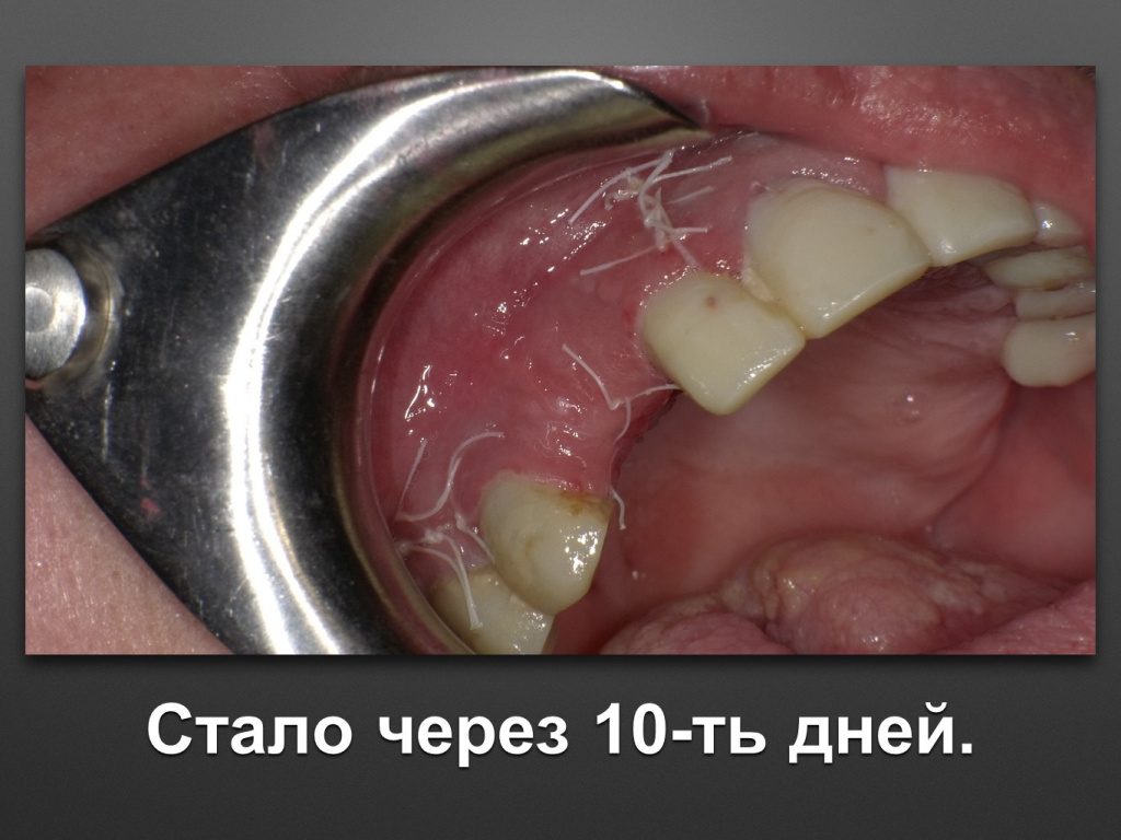 БАЛДЕЙ НОГА